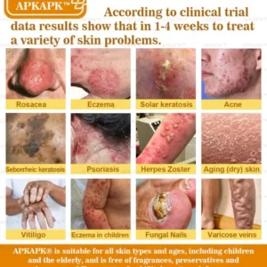 APKAPK™ Bee Venom Skin Treatment Cream 41 APKAPK™ Bee Venom Skin Treatment Cream