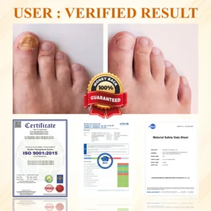 Fivfivgo® Fungiclear Bee Therapy Nail Spray 21 Fivfivgo® Fungiclear Bee Therapy Nail Spray