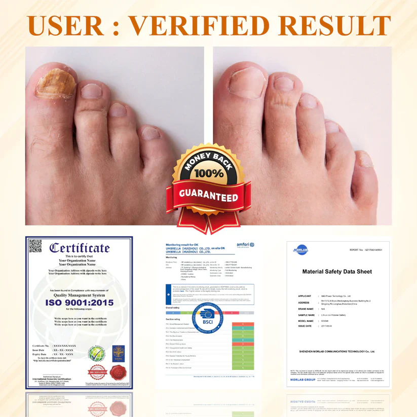 Fivfivgo® Fungiclear Bee Therapy Nail Spray 10 Fivfivgo® Fungiclear Bee Therapy Nail Spray