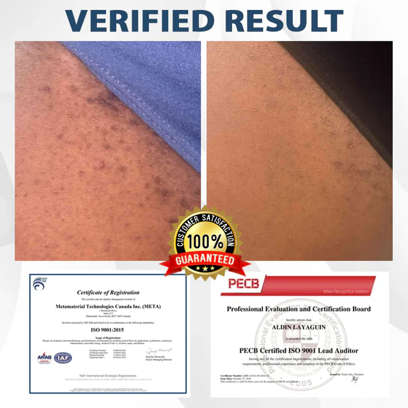 Fivfivgo® ManGuard HPV WART Healing Cream 3 Fivfivgo® ManGuard HPV WART Healing Cream