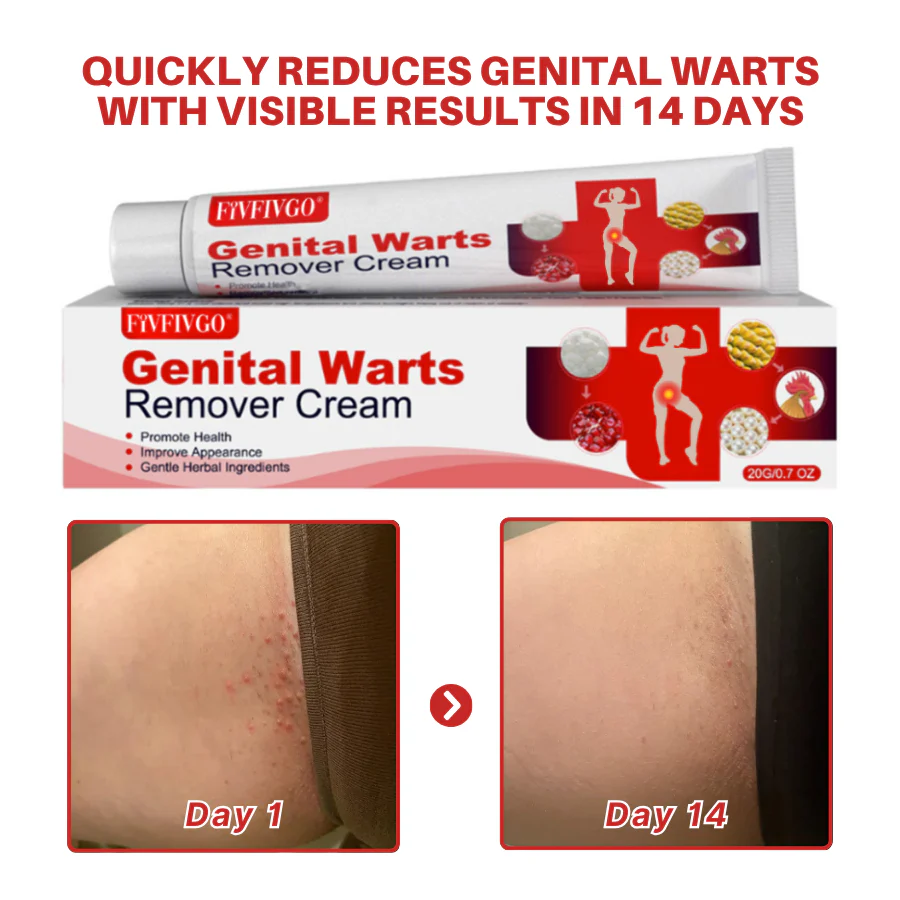 Fivfivgo® FloraGuard HPV Genital Warts Remover 6 Fivfivgo® FloraGuard HPV Genital Warts Remover