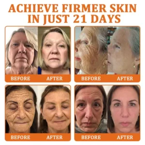 Flysmus Botox Bee Venom Treatment Serum Stick 20 Flysmus Botox Bee Venom Treatment Serum Stick