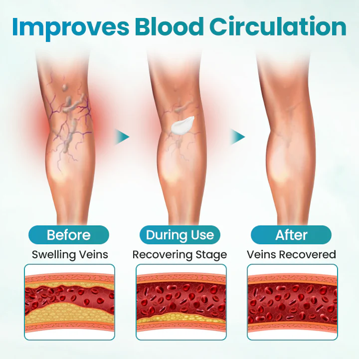 Fivfivgo® VeinEase Soothing Cream 7 Fivfivgo® VeinEase Soothing Cream