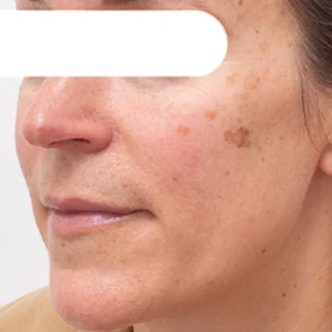 Fivfivgo™ Herbal Spots Peel-Off Facial Mask