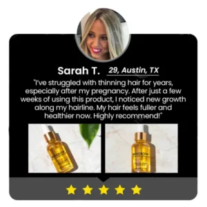 Fivfivgo™ BeeGrow Follicle Reviving Hair Essence 22 Fivfivgo™ BeeGrow Follicle Reviving Hair Essence