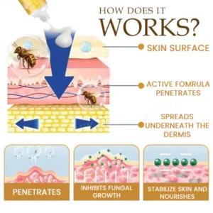 Fivfivgo® Bee Venom Genital Itch Relief Cream 8 Fivfivgo® Bee Venom Genital Itch Relief Cream