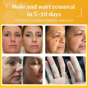 Flysmus® Bee Venom All-in-One Cream 14 Flysmus® Bee Venom All-in-One Cream