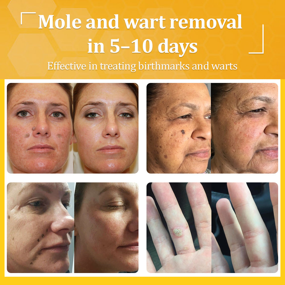 Flysmus® Bee Venom All-in-One Cream 6 Flysmus® Bee Venom All-in-One Cream