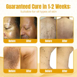 Fivfivgo™ Bee Venom Multi-Skin Treatment Spray 10 Fivfivgo™ Bee Venom Multi-Skin Treatment Spray