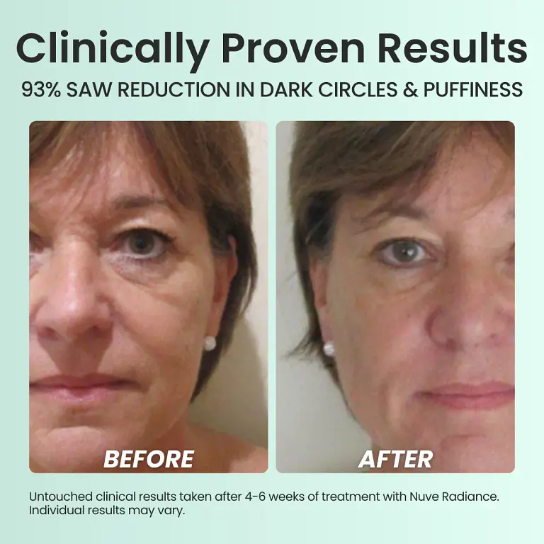 Nuve Radiance 4 Nuve Radiance