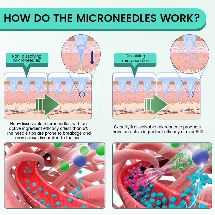 Ceoerty® Slimura GLP-1 Nano Microneedle Patch 3 Ceoerty® Slimura GLP-1 Nano Microneedle Patch