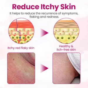 Fivfivgo® Women’s GentY HPV Relief Cream 6 Fivfivgo® Women’s GentY HPV Relief Cream