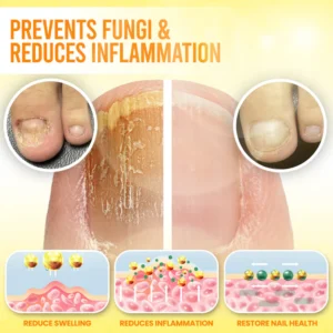 Fivfivgo® ClariNail Bee Venom Fungal Solution Drops 12 Fivfivgo® ClariNail Bee Venom Fungal Solution Drops