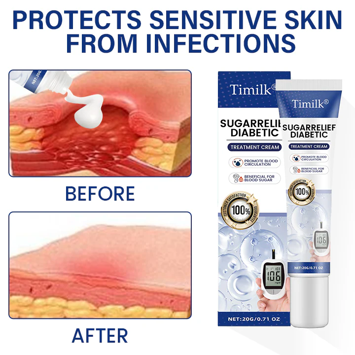 Timilk® SugarRelief Diabetic Treatment Cream 3 Timilk® SugarRelief Diabetic Treatment Cream