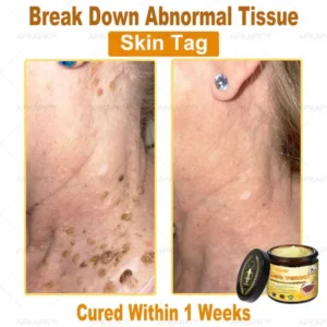 APKAPK™ Bee Venom Skin Treatment Cream 39 APKAPK™ Bee Venom Skin Treatment Cream