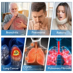 Ourlyard DoubleNano Advanced Lung Detox Relief Patch 14 Ourlyard DoubleNano Advanced Lung Detox Relief Patch