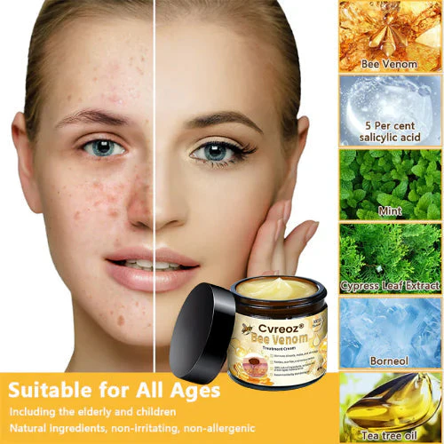 Cvreoz® Bee Venom Skin Treatment Cream 12 Cvreoz® Bee Venom Skin Treatment Cream