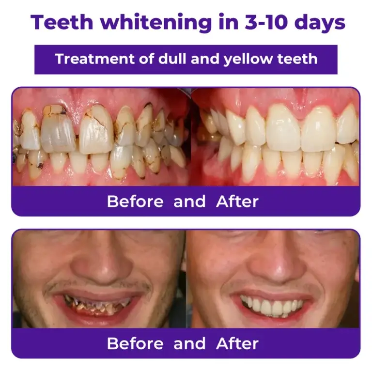 Dobshow™ Dental Repair Mineral Powder 7 Dobshow™ Dental Repair Mineral Powder