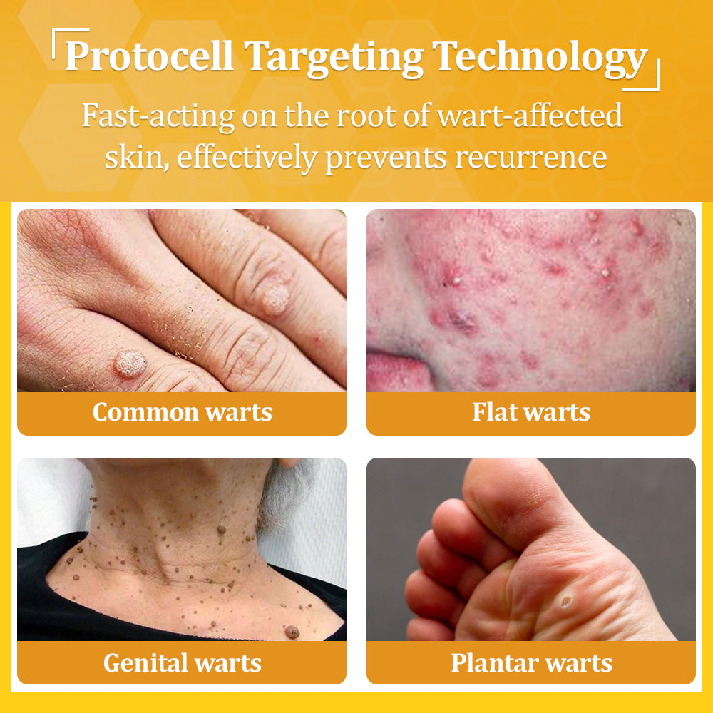 Flysmus® Bee Venom All-in-One Cream 5 Flysmus® Bee Venom All-in-One Cream