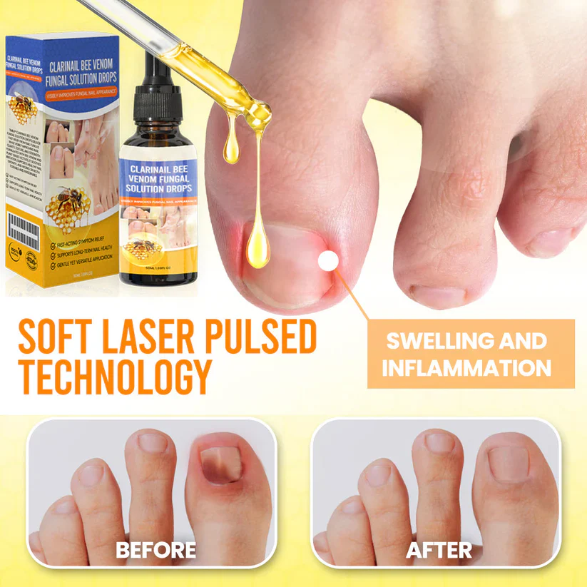 Fivfivgo® ClariNail Bee Venom Fungal Solution Drops 4 Fivfivgo® ClariNail Bee Venom Fungal Solution Drops