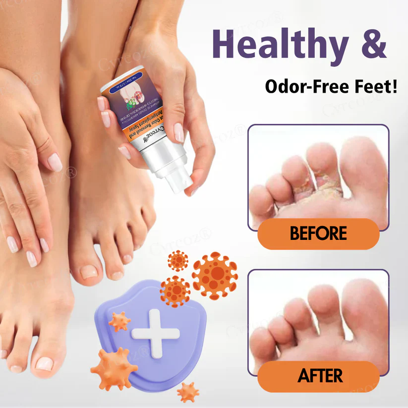 Cvreoz® FreshStep Foot Odor and Nail Fungus Spray 4 Cvreoz® FreshStep Foot Odor and Nail Fungus Spray