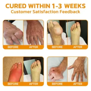 flysmus™ Bee-Venom Pain-Relief Bone Healing Cream 11 flysmus™ Bee-Venom Pain-Relief Bone Healing Cream