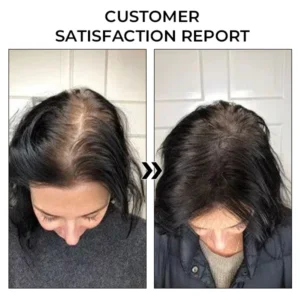 Fivfivgo™ BeeGrow Follicle Reviving Hair Essence 14 Fivfivgo™ BeeGrow Follicle Reviving Hair Essence