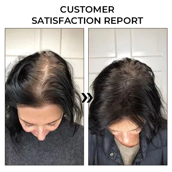 Fivfivgo™ BeeGrow Follicle Reviving Hair Essence 2 Fivfivgo™ BeeGrow Follicle Reviving Hair Essence