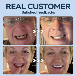 YUNPSO™– Premium Adaptive Dentures 19 YUNPSO™– Premium Adaptive Dentures