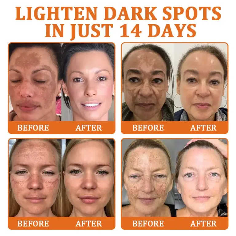 Flysmus Botox Bee Venom Treatment Serum Stick 7 Flysmus Botox Bee Venom Treatment Serum Stick