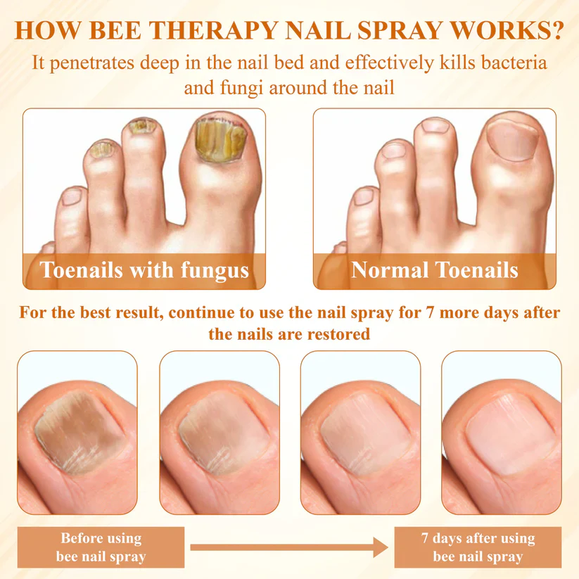 Fivfivgo® Fungiclear Bee Therapy Nail Spray 7 Fivfivgo® Fungiclear Bee Therapy Nail Spray