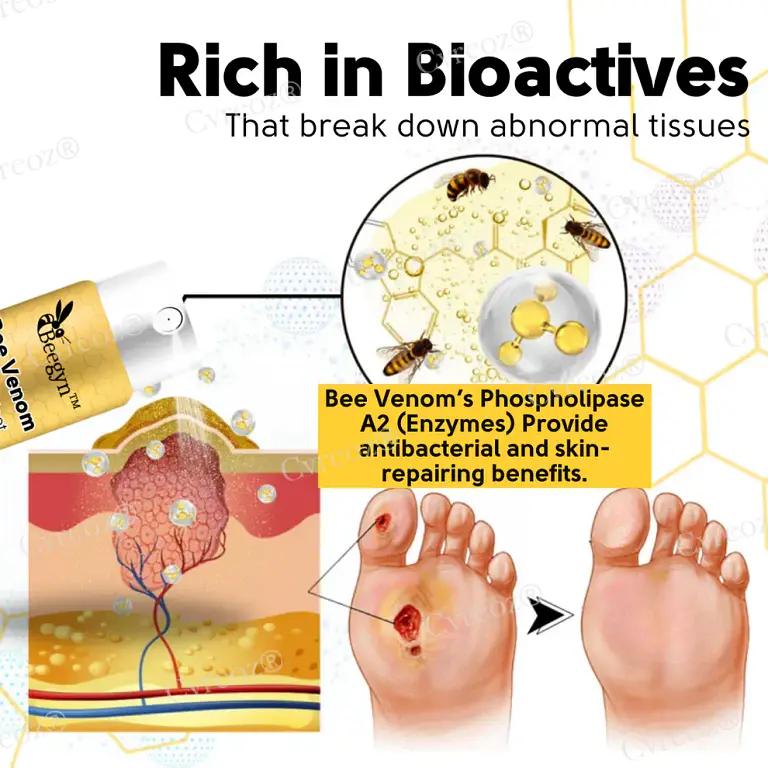 Cvreoz® Bee Venom Diabetic Foot Treatment Spray 4 Cvreoz® Bee Venom Diabetic Foot Treatment Spray