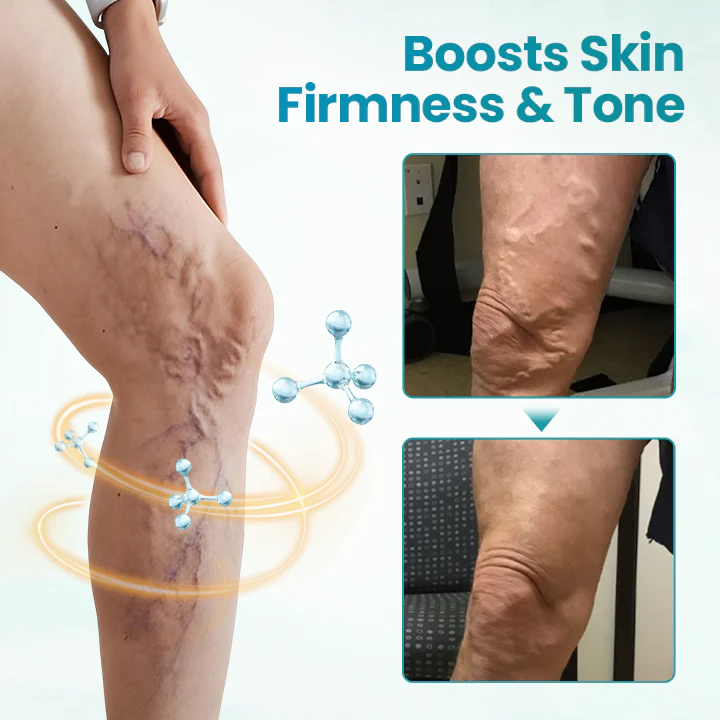 Fivfivgo® VeinEase Soothing Cream 6 Fivfivgo® VeinEase Soothing Cream