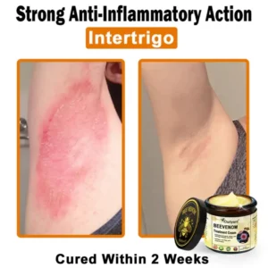 Ourlyard® Botulinum Toxin & Bee Venom Skin Treatment Cream 19 Ourlyard® Botulinum Toxin & Bee Venom Skin Treatment Cream