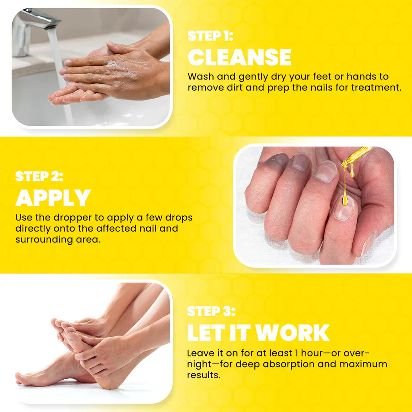 Fivfivgo® ClariNail Bee Venom Fungal Solution Drops 3 Fivfivgo® ClariNail Bee Venom Fungal Solution Drops