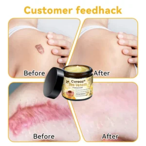 Cvreoz® Bee Venom Skin Treatment Cream 22 Cvreoz® Bee Venom Skin Treatment Cream