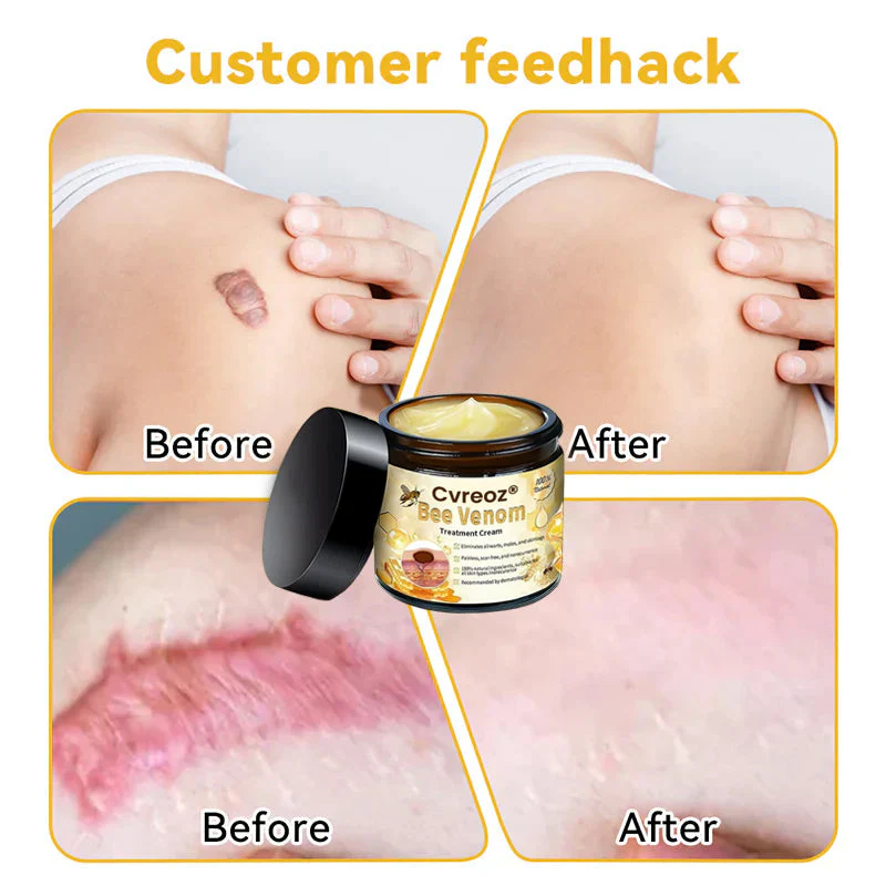 Cvreoz® Bee Venom Skin Treatment Cream 10 Cvreoz® Bee Venom Skin Treatment Cream