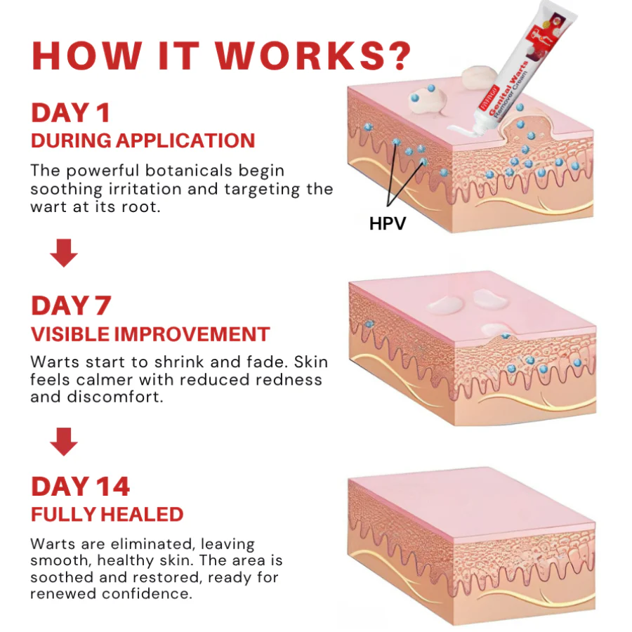 Fivfivgo® FloraGuard HPV Genital Warts Remover 3 Fivfivgo® FloraGuard HPV Genital Warts Remover