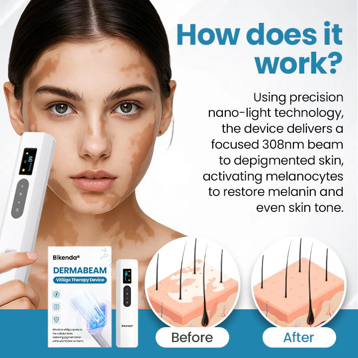 Bikenda® DermaBeam Vitiligo Therapy Device 7 Bikenda® DermaBeam Vitiligo Therapy Device