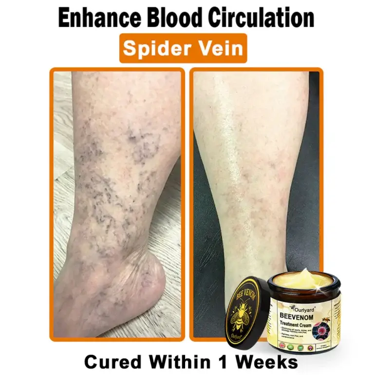 Ourlyard® Botulinum Toxin & Bee Venom Skin Treatment Cream 7 Ourlyard® Botulinum Toxin & Bee Venom Skin Treatment Cream