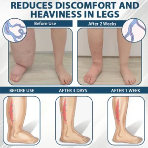 Fivfivgo® VenoHerb Black Cumin Edema Relief Balm 21 Fivfivgo® VenoHerb Black Cumin Edema Relief Balm