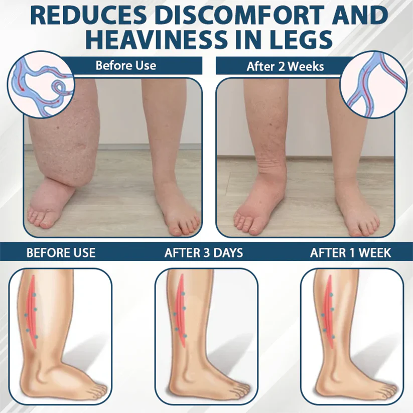 Fivfivgo® VenoHerb Black Cumin Edema Relief Balm 8 Fivfivgo® VenoHerb Black Cumin Edema Relief Balm