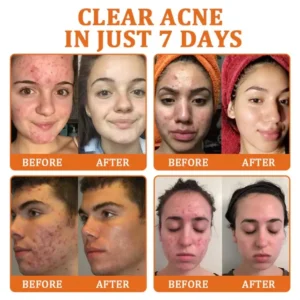 Flysmus Botox Bee Venom Treatment Serum Stick 16 Flysmus Botox Bee Venom Treatment Serum Stick