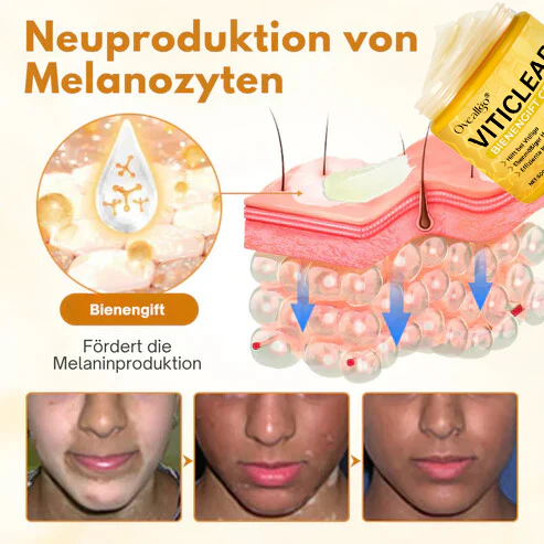 Oveallgo® VitiClear Prox Bee Venom Cream 5 Oveallgo® VitiClear Prox Bee Venom Cream