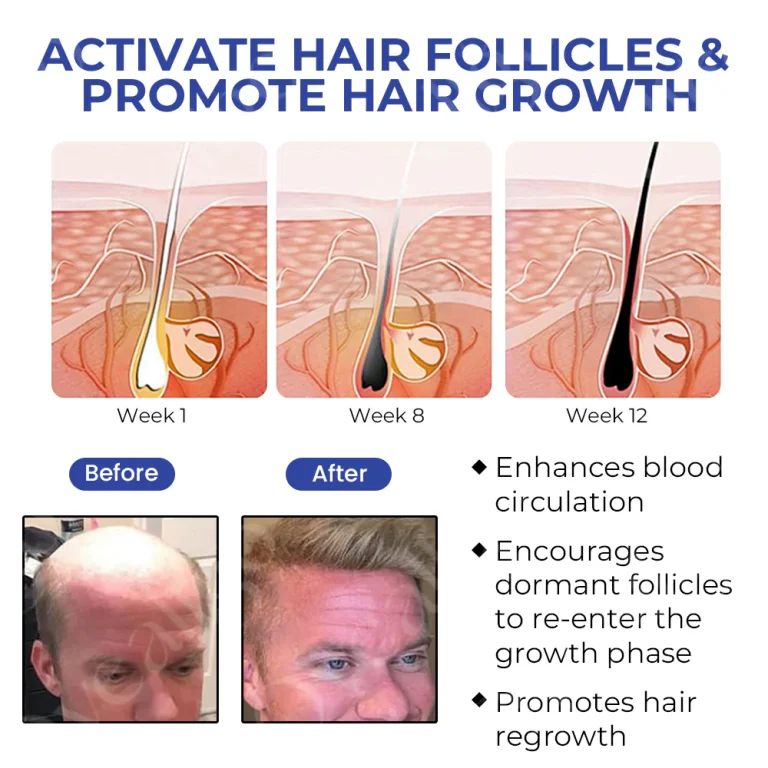 Fivfivgo™ BeeGrow Follicle Reviving Hair Essence 5 Fivfivgo™ BeeGrow Follicle Reviving Hair Essence