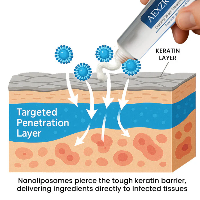 AEXZR® HPV Genital Wart Treatment Cream 3 AEXZR® HPV Genital Wart Treatment Cream