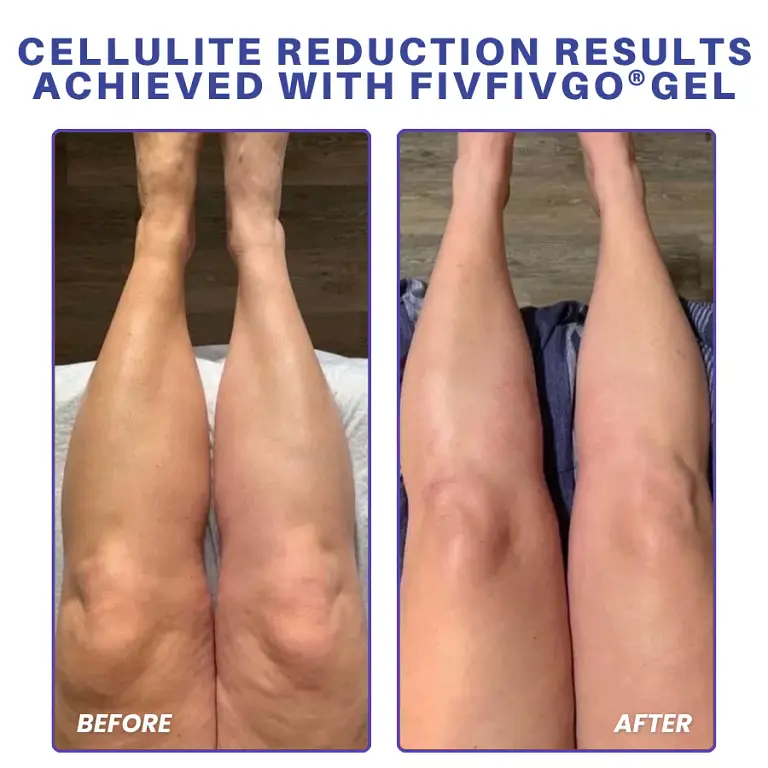 Fivfivgo® PDRN-GLP-1 Cellulite Targeting Reedle Shot Gel 10 Fivfivgo® PDRN-GLP-1 Cellulite Targeting Reedle Shot Gel