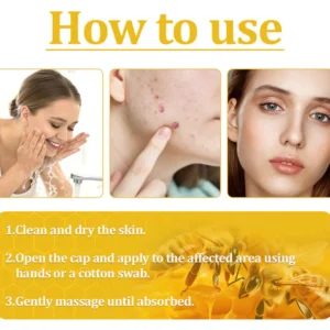 Cvreoz® Bee Venom Skin Treatment Cream 20 Cvreoz® Bee Venom Skin Treatment Cream