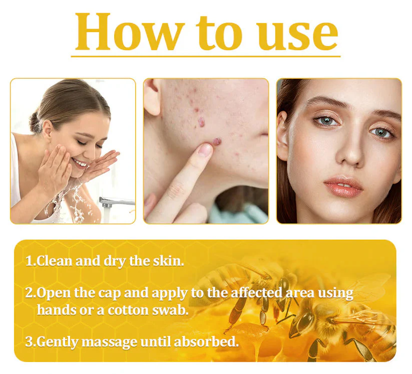 Cvreoz® Bee Venom Skin Treatment Cream 8 Cvreoz® Bee Venom Skin Treatment Cream