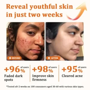 Flysmus Botox Bee Venom Treatment Serum Stick 15 Flysmus Botox Bee Venom Treatment Serum Stick